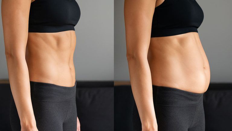 ¿Tienes la barriga hinchada? Esto se llama distensión abdominal y tiene solución